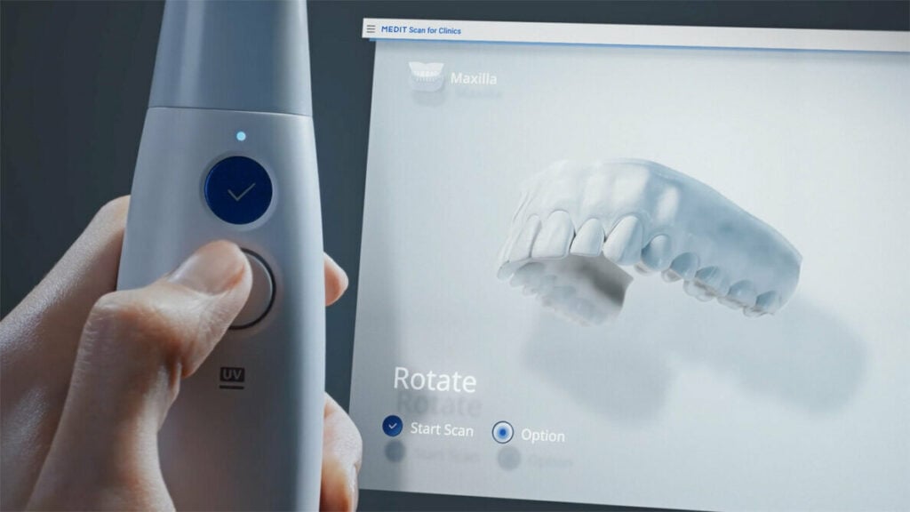 Image of an intraoral scanner being held by a left hand infront of a computer showing the scan.